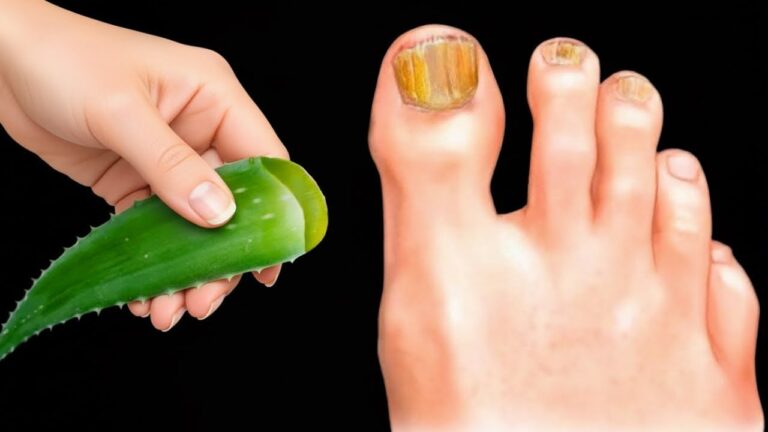 Nadie imaginó que el aloe… ¡destruye el hongo de uñas al instante! 🌿✨