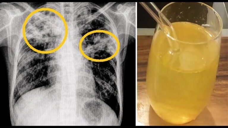 Plantas de interior : 7 errores comunes que empeoran su salud sin saberlo
