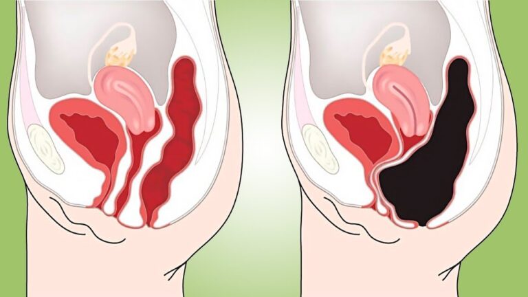 5 errores en tu huerto que empeoran tus verduras sin saberlo